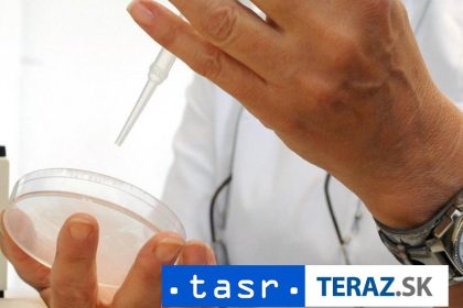 Slovaci v prestiznom casopise Ich inhibitor pomoze odhalit virus