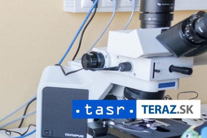 Vzacny nalez Tim vedcov nahodou objavil jednobunkovca