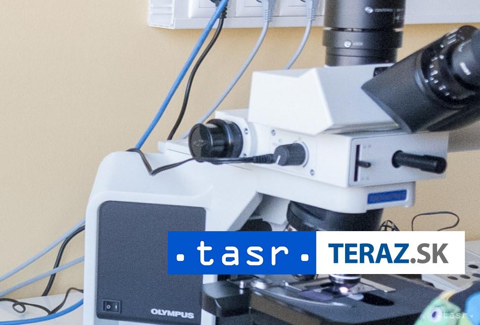 Vzacny nalez Tim vedcov nahodou objavil jednobunkovca