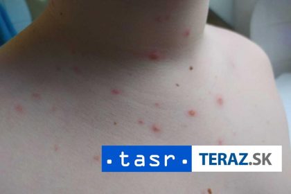 Na osypyky v Banglad esti zomrelo takmer 500 det